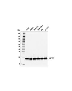 Cell Signaling AP1S1 (F8K5S) Rabbit mAb 20 uL