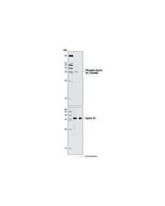 Cell Signaling Phospho-Cyclin D1 (Thr286) (D29b3) Xp Rabbit mAb