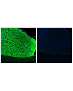 Cell Signaling Phospho-Tau (Thr205) (E9a7p) Mouse mAb