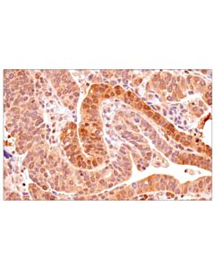 Cell Signaling p70 S6 Kinase (E8K6T) XP ® Rabbit mAb (BSA and Azide Free)