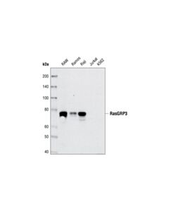 Cell Signaling RasGRP3 (C33A3) Rabbit mAb 20 uL