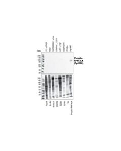 Cell Signaling Phospho-Alk (Tyr1586) Antibody