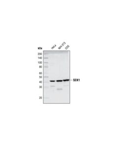 Cell Signaling SEK1 (5C10) Rabbit mAb 20 uL