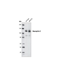 Cell Signaling Neuropilin-2 (D39a5) Xp Rabbit mAb