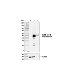 Cell Signaling Sars-Cov-2 Nucleocapsid Protein (E8r1l) Mouse mAb