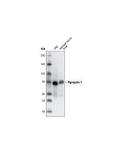 Cell Signaling Presynaptic Vesicle Cycle Antibody Sampler Kit