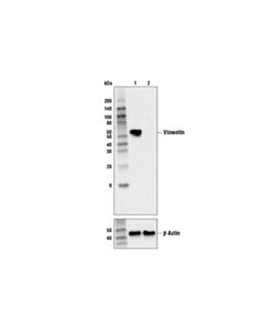 Cell Signaling Vimentin (5G3F10) Mouse mAb 20 uL