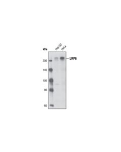 Cell Signaling Lrp6 (C47e12) Rabbit mAb