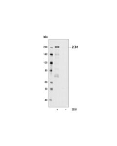 Cell Signaling Zeb1 (D80d3) Rabbit mAb