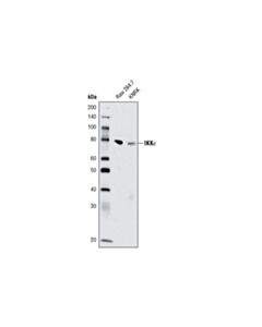 Cell Signaling Ikkepsilon (D61f9) Xp Rabbit mAb