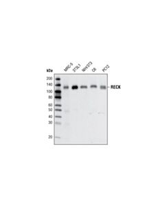 Cell Signaling Reck (D8c7) Rabbit mAb