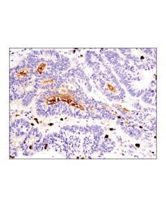Cell Signaling S100a9 (D5o6o) Rabbit mAb (Ihc Formulated)