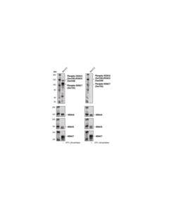 Cell Signaling Phospho-Hdac4 (Ser246)/Hdac5 (Ser259)/Hdac7 (Ser155) (D27b5) Rabbit mAb