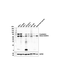 Cell Signaling ADAM10 (F8D7P) Rabbit mAb