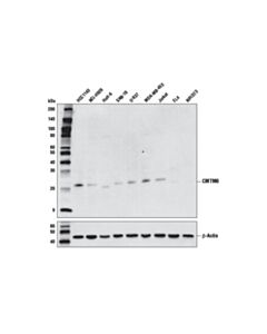 Cell Signaling Cmtm6 Antibody