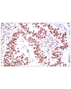 Cell Signaling Hdac1 (D5c6u) Xp Rabbit mAb