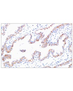 Cell Signaling ADAM10 (F9A4J) Rabbit mAb