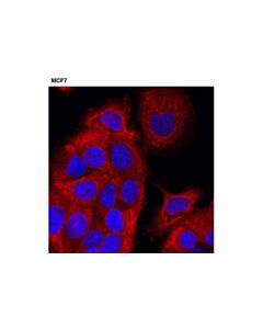 Cell Signaling Pan-Keratin (C11) Mouse mAb (Alexa Fluor 555 Conjugate)