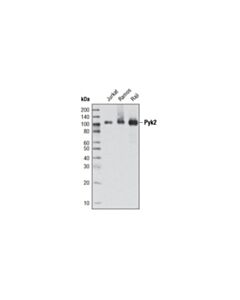 Cell Signaling Pyk2 (5E2) Mouse mAb 20 uL