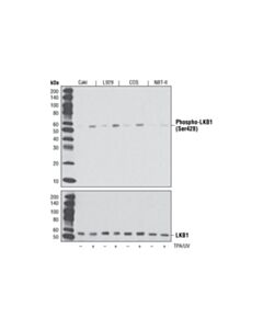 Cell Signaling Phospho-Lkb1 (Ser428) (C67a3) Rabbit mAb