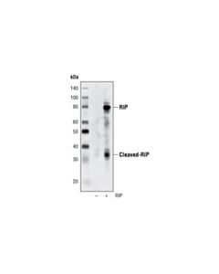 Cell Signaling Rip (D94c12) Xp<LT/>Sup&Gt;®<LT/>/Sup&Gt; Rabbit mAb