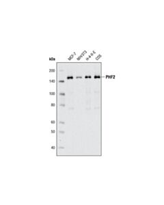 Cell Signaling Phf2 (D45a2) Rabbit mAb