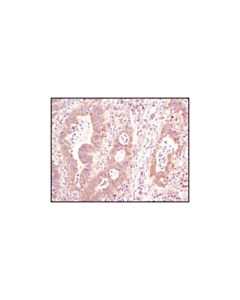 Cell Signaling Asymmetric-Methyl-Pabp1 (Arg455/Arg460) (C60a10) Rabbit mAb