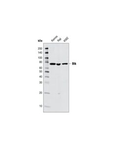 Cell Signaling Btk (C82b8) Rabbit mAb