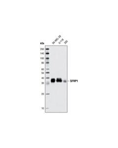 Cell Signaling SFRP1 (D5A7) Rabbit mAb 20 uL