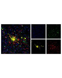 Cell Signaling Beta-Amyloid (D54d2) Xp<LT/>Sup&Gt;®<LT/>/Sup&Gt; Rabbit mAb (Alexa Fluor<LT/>Sup&Gt;®<LT/>/Sup&Gt; 594 Conjugate)