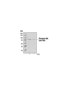 Cell Signaling Phospho-Btk (Ser180) (3d3) Mouse mAb