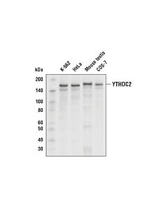 Cell Signaling Ythdc2 Antibody