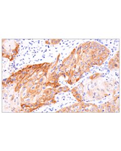 Cell Signaling TrkB (F8L9G) Rabbit mAb (BSA and Azide Free)