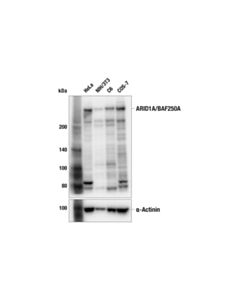 Cell Signaling ARID1A/BAF250A (F3R4E) Rabbit mAb