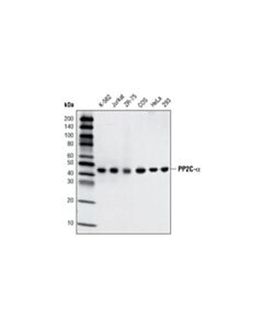 Cell Signaling Pp2c-Alpha (D18c10) Xp Rabbit mAb
