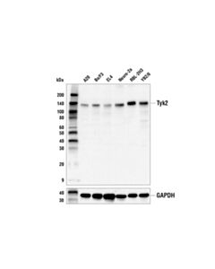 Cell Signaling Tyk2 (E9H4T) Rabbit mAb 20 uL