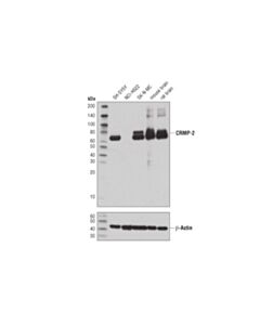 Cell Signaling Crmp-2 (D8l6v) Rabbit mAb