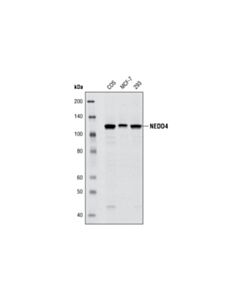 Cell Signaling NEDD4 (C5F5) Rabbit mAb 20 uL