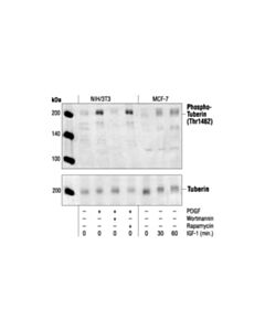 Cell Signaling Tuberin/Tsc2 Antibody
