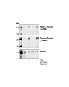 Cell Signaling Phospho-Tuberin/Tsc2 (Ser939) Antibody