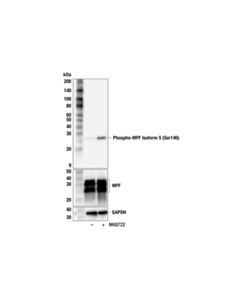 Cell Signaling Phospho-MFF Isoform 5 (Ser146) (F5U3I) Rabbit mAb