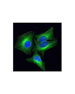Cell Signaling Beta-Tubulin (9f3) Rabbit mAb (Alexa Fluor 488 Conjugate)