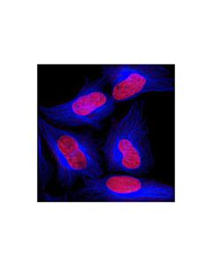 Cell Signaling Beta-Tubulin (9f3) Rabbit mAb (Alexa Fluor 647 Conjugate)