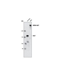 Cell Signaling NUT (C52B1) Rabbit Monoclonal Antibody