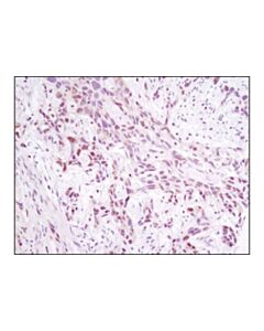 Cell Signaling Nfat1 (D43b1) Xp Rabbit mAb (BSA And Azide Free)