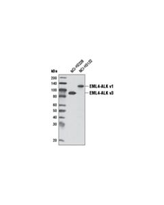Cell Signaling ALK (D5F3) Rabbit Monoclonal Antibody