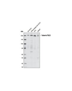 Cell Signaling Tuberin/TSC2 (28A7) Rabbit mAb 20 uL