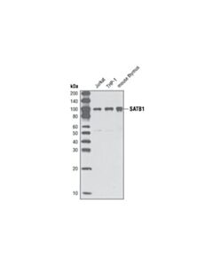 Cell Signaling Satb1 (P472) Antibody