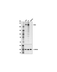 Cell Signaling TET2 (D6C7K) Rabbit mAb 20 uL