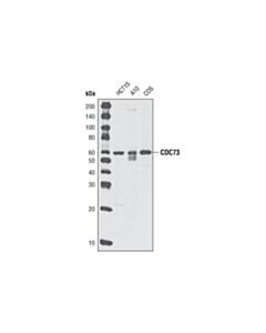Cell Signaling Cdc73 (A264) Antibody